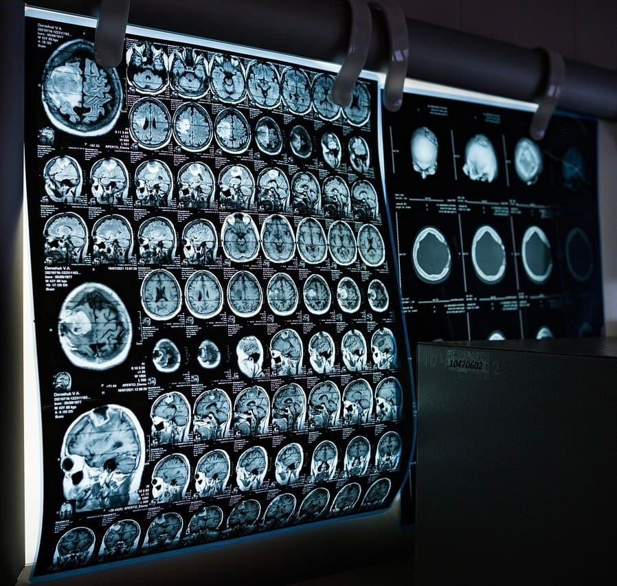 Imágenes de resonancia cerebral que simbolizan el aprendizaje médico aplicado y el pensamiento clínico en MedInsight